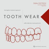 Tooth Wear