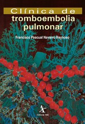 Clínica de tromboembolia pulmonar