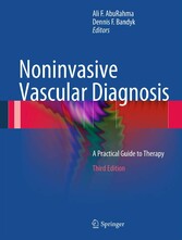 Noninvasive Vascular Diagnosis