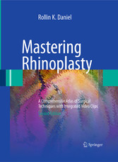 Mastering Rhinoplasty