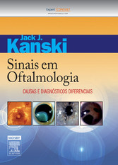 Sinais em Oftalmologia